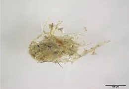 原料から
茶色の異物が見つかった