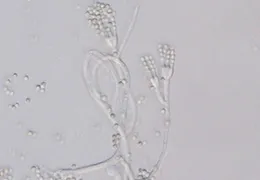 顕微鏡観察：
カビに特徴的な菌糸、胞子が認められた