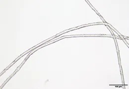 顕微鏡観察：
合成繊維が認められた